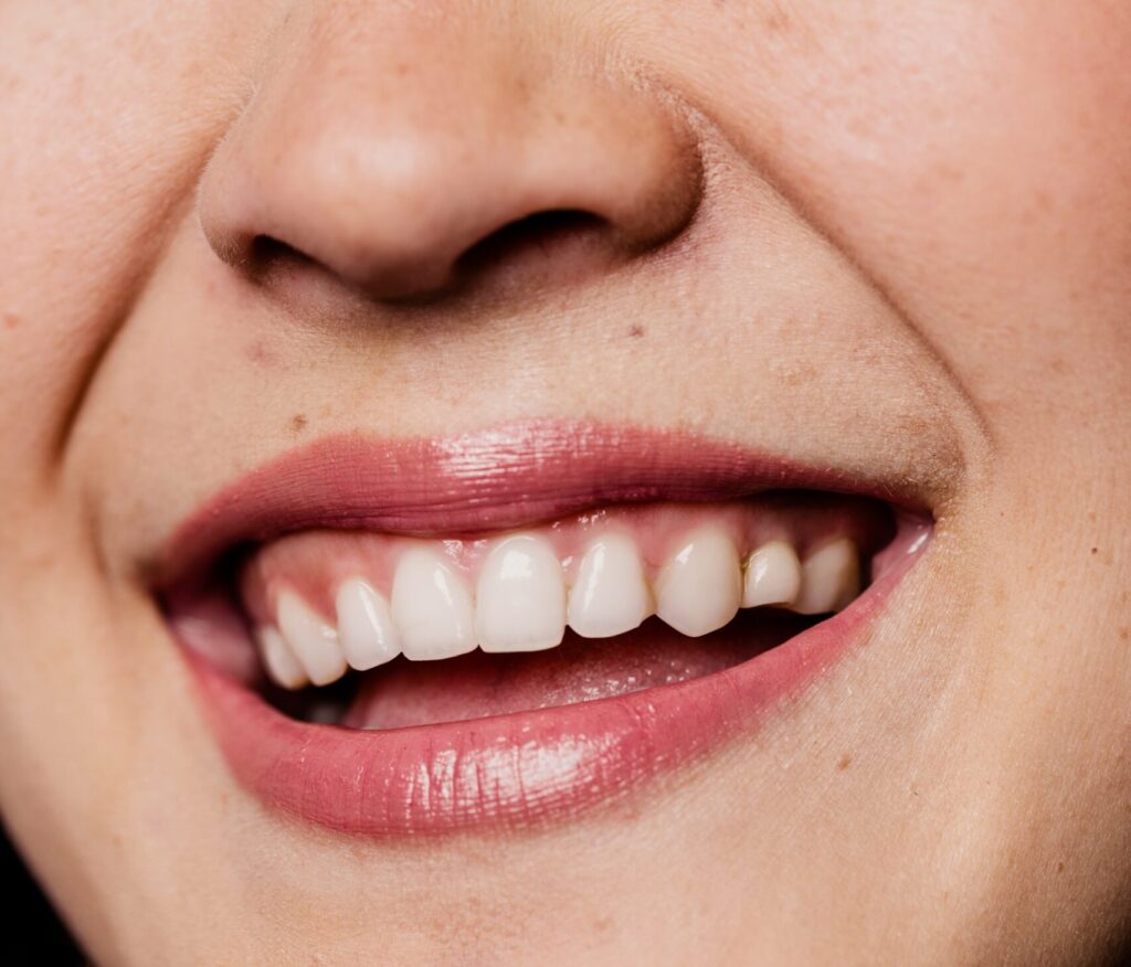 Tratamientos de estética dental para mejorar la autoestima en Delgado Dental Digital